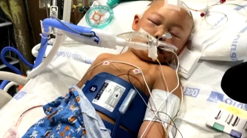 Court documents show 6-year-old Jeremy has multiple skull fractures and brain swelling after...